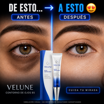¡2X1! VELUNE® Elimina Ojeras y Arrugas